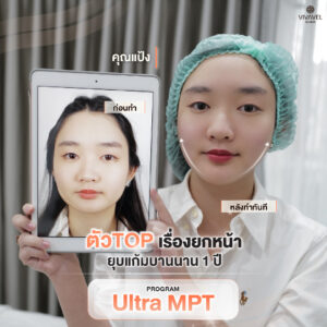 review ultraformer mpt vivavel clinic